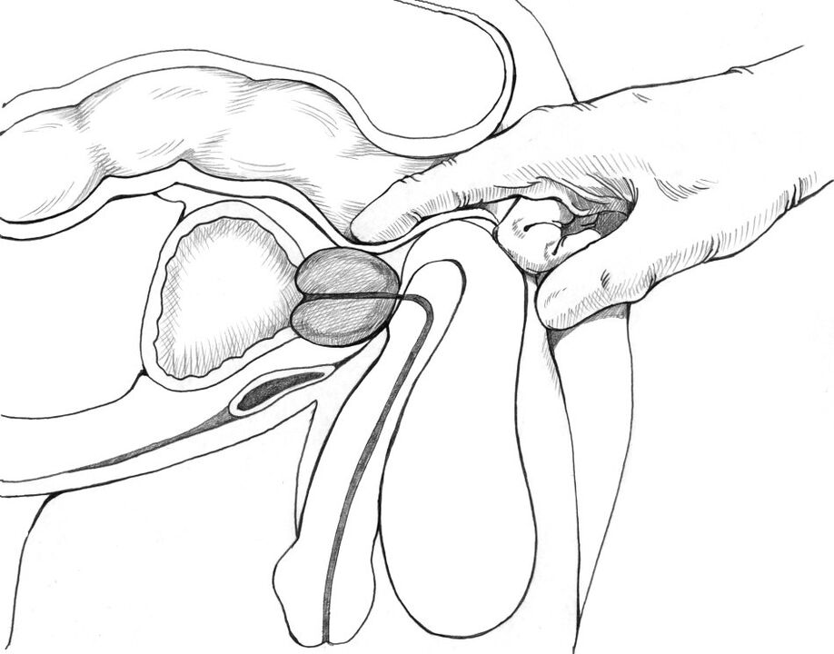 Il massaggio prostatico appartiene al complesso dei metodi per il trattamento della prostatite